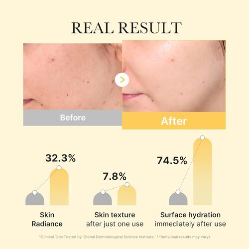 [MEDICUBE] Kojic Acid Turmeric Gel Mask (4 stuks)