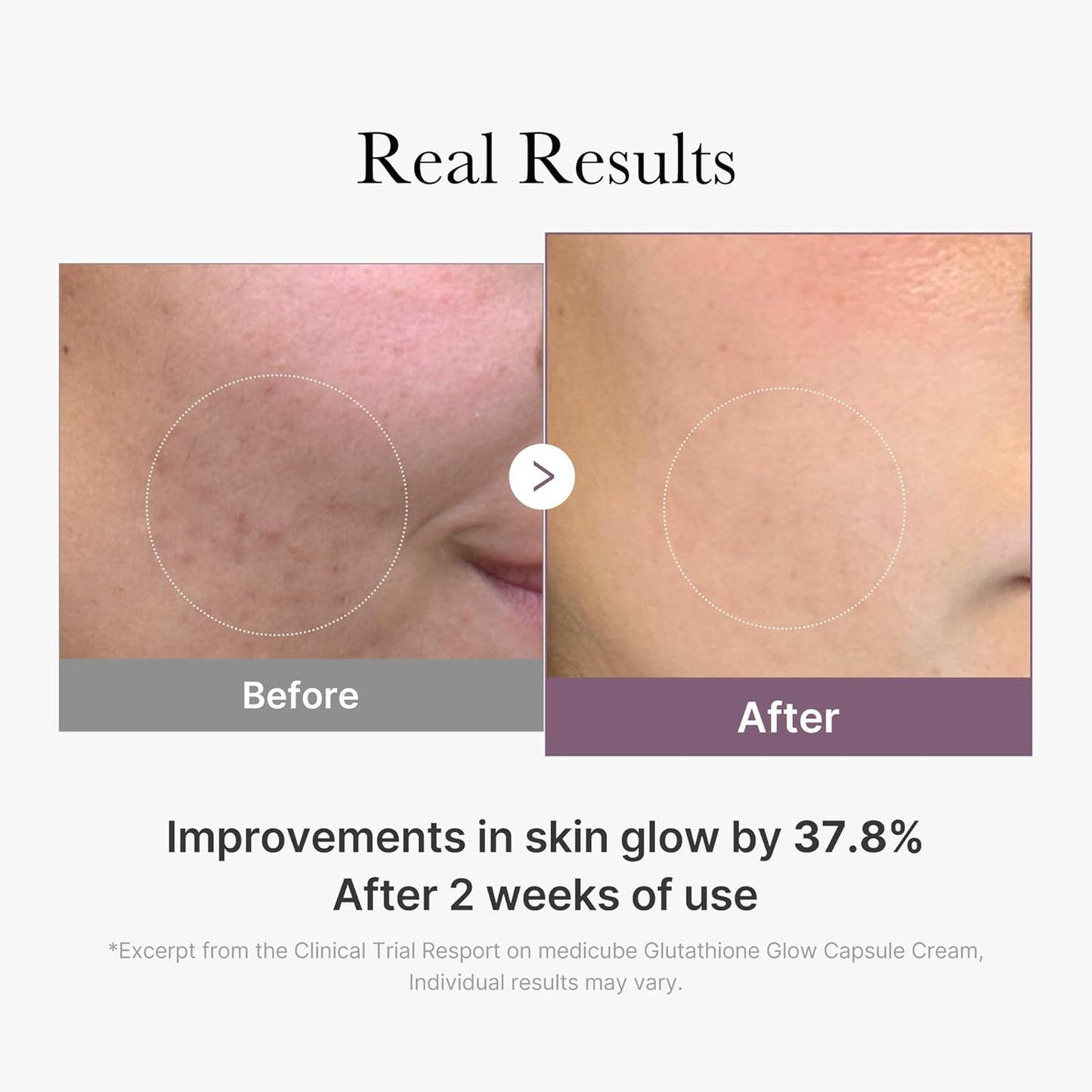 [MEDICUBE] AGE-R Glutathione Glow Capsule Cream 50ml