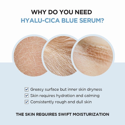 [SKIN1004] Madagascar Centella Hyalu-Cica Blue Serum