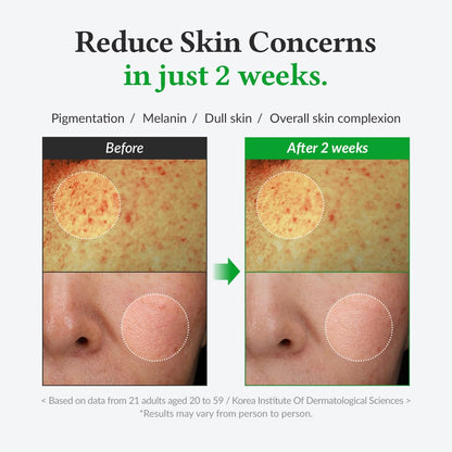 [Dr. Althea] Gentle Vitamin C Serum 30ml